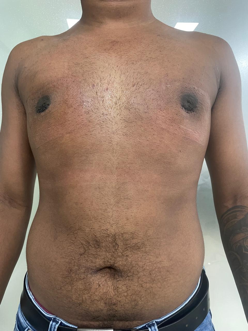 Post Operation X-ray